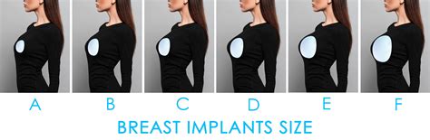 1200cc breast implants|Extra Large Breast Implants .